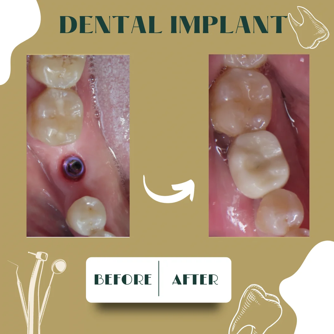 Dental clinical case 2, before and after